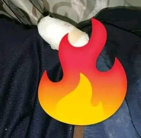 Violence conjugale: une femme arrache avec les dents la tête du p€nis de son mari