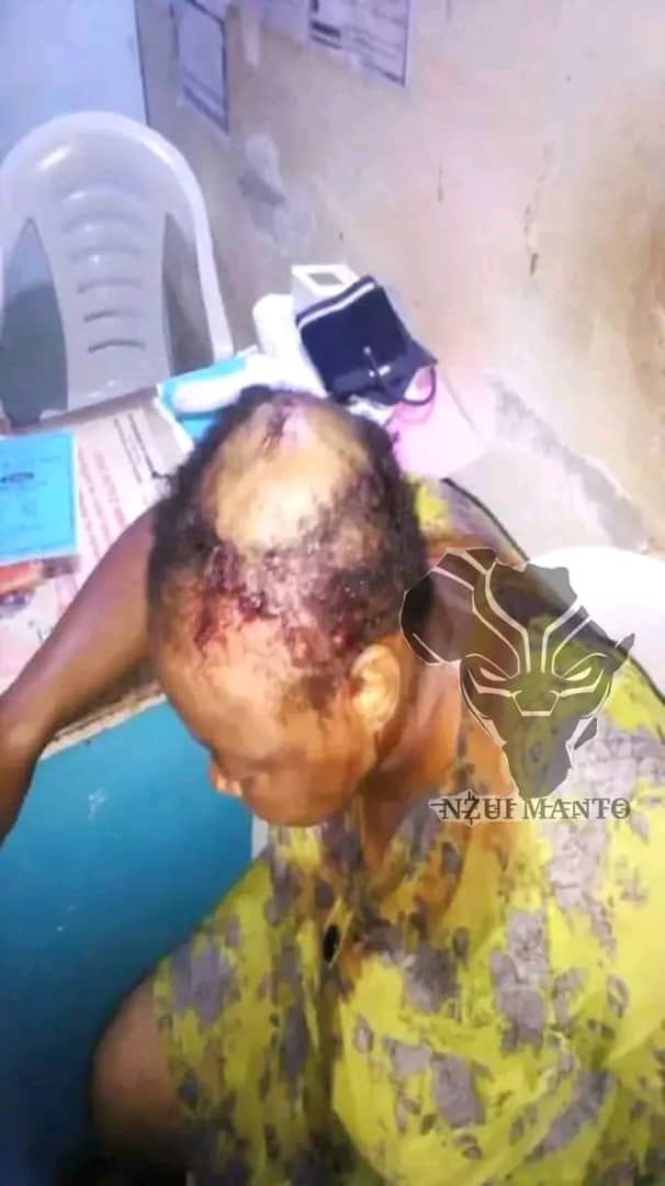 JIF 2025: un 08 mars noir pour une comédienne, son mari lui a ouvert le crâne pour une simple causerie 