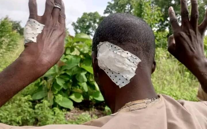 Sinendé : une nouvelle attaque à domicile, un éleveur et sa femme tabassés